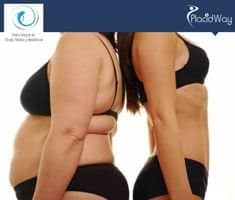 Slider image (4) Clinica Rivera | Cosmetic Surgery